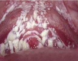 ù��������֢״ͼ