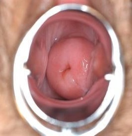 �����ʴ�ͼƬ