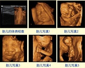 ����������ά�ʳ���