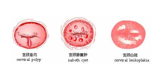 �����װ�ͼƬ