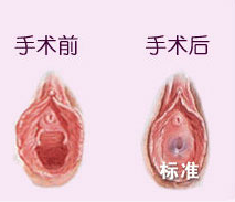 ��ŮĤ�޸�ͼ