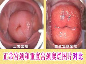 �ضȹ�������֢״ͼ