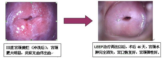 3�ȹ�����������Ч��ͼ